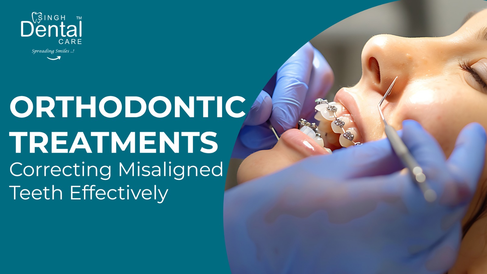 Orthodontic Treatments