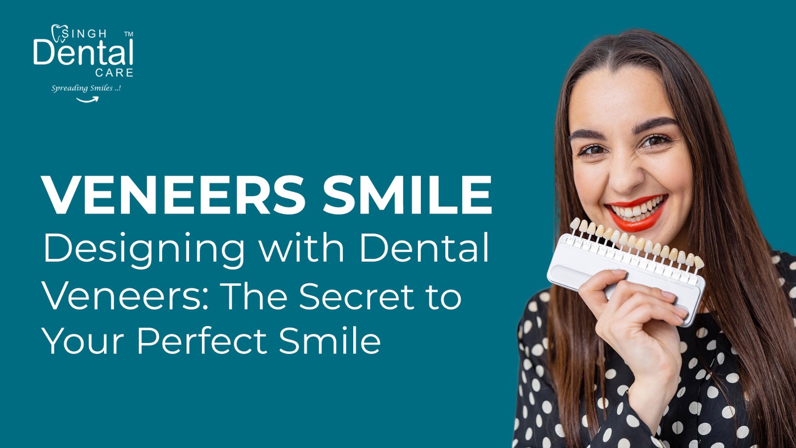 VeneersSmile Designing with Dental Veneers: The Secret to Your Perfect Smile