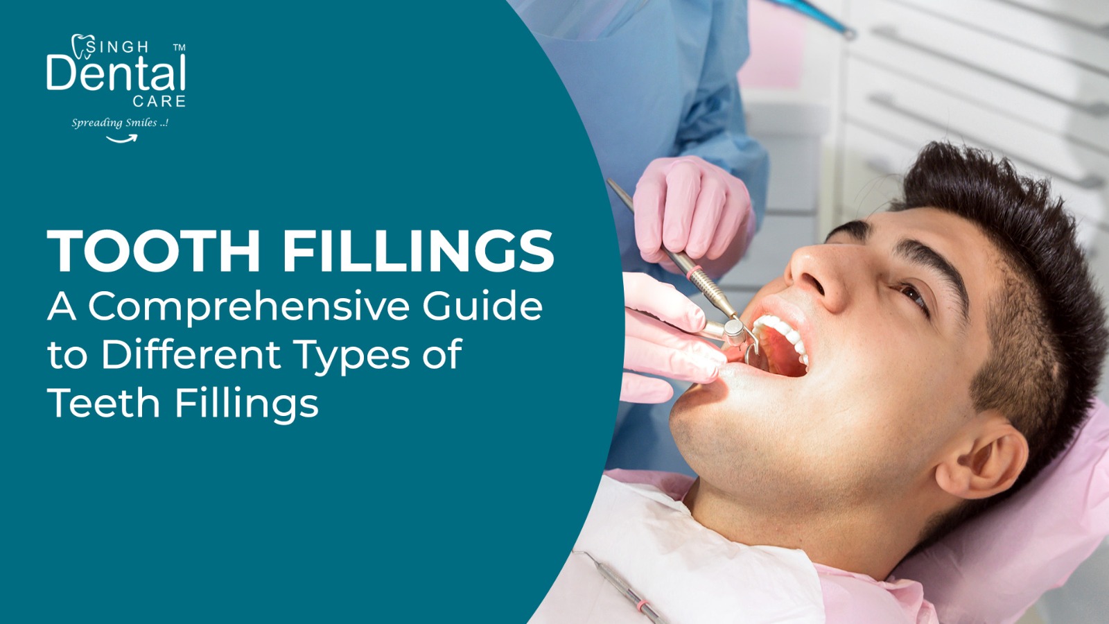 Tooth fillings : A Comprehensive Guide to Different Types of Teeth Fillings