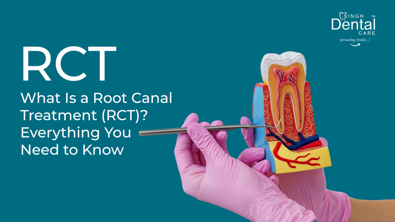 what is rct