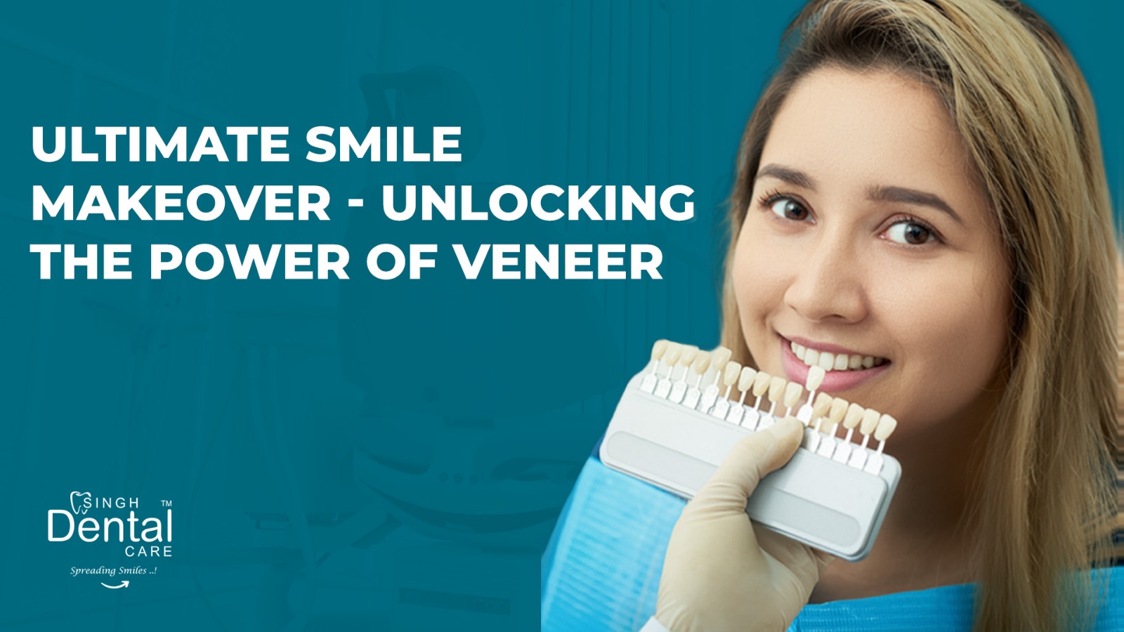 Ultimate Smile Makeover – Unlocking the power of veneers