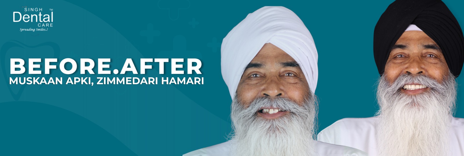 before after treatment