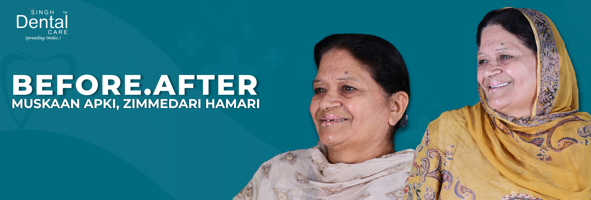 before after teeth result