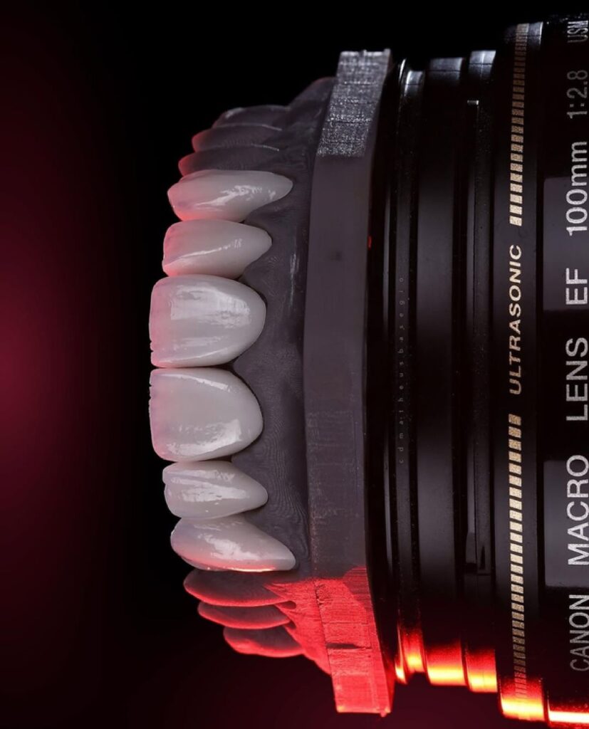 Digital Smile Designing