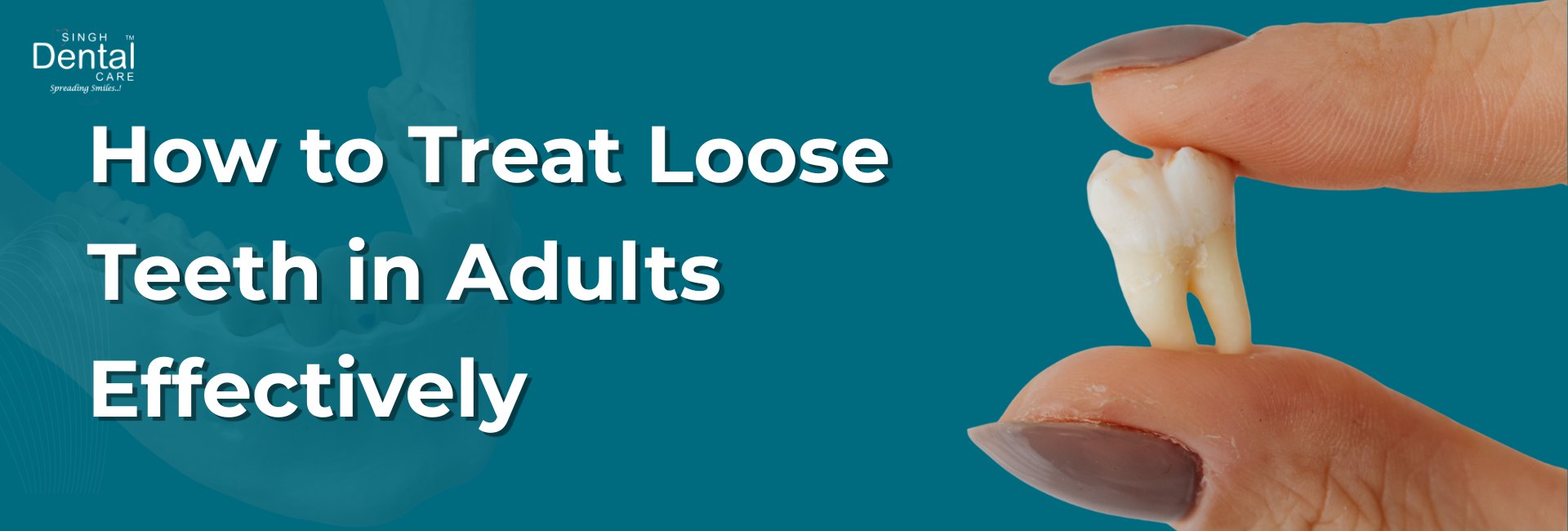loose teeth treatment
